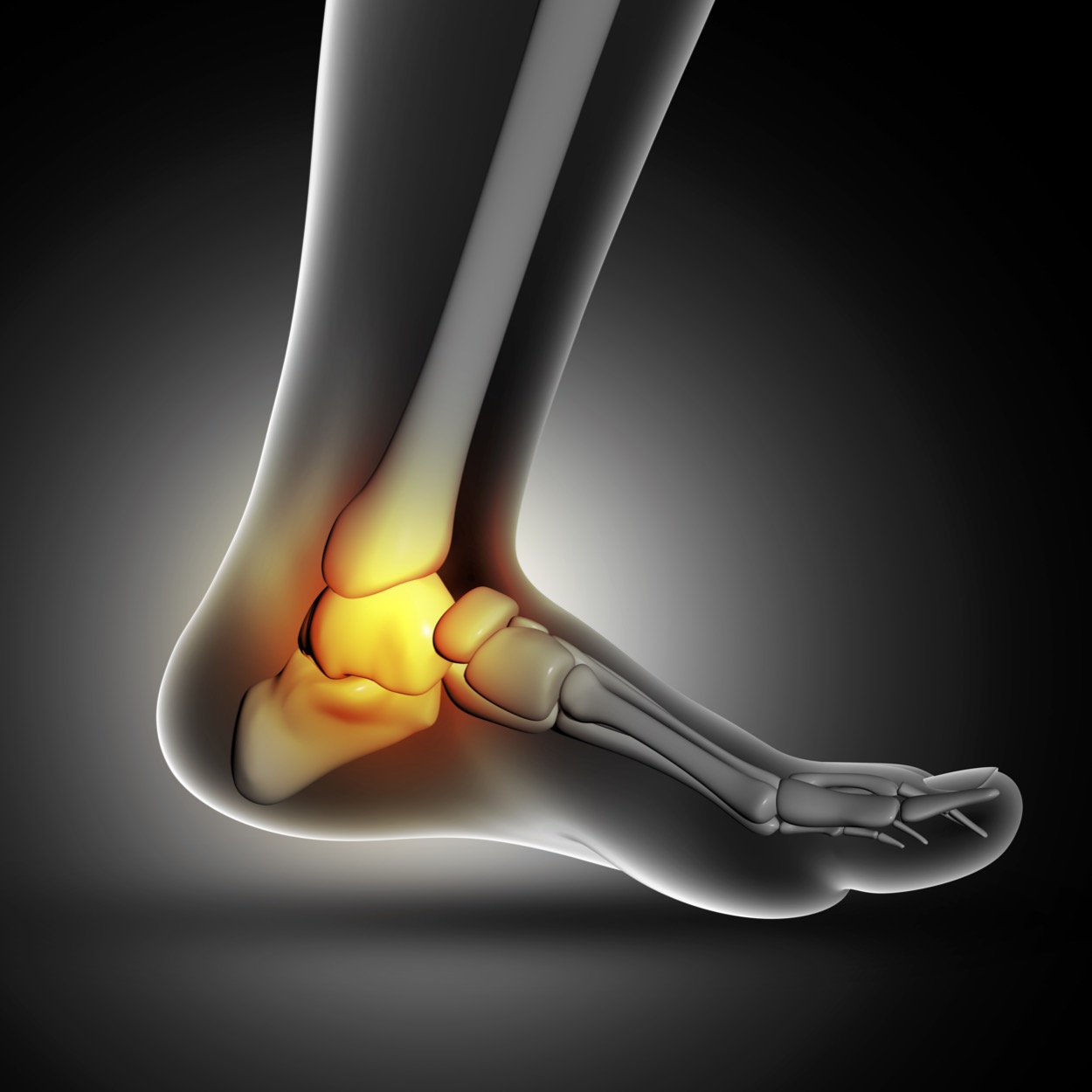 Ankle joint affected by arthritis and inflammation.
